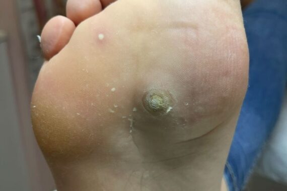 https://pedichiuramedicalabacau.ro/wp-content/uploads/2025/10/bataturi-570x380.jpg
